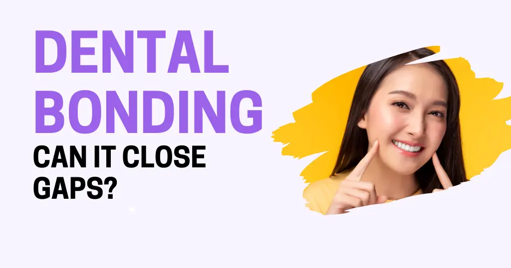 Dental Bonding Closing Gaps