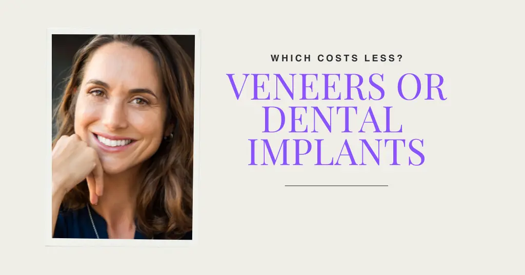 Veneers Or Dental Implants Cost