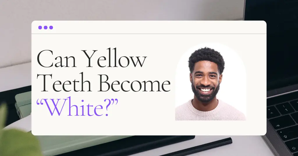 Can Yellow Teeth Become White